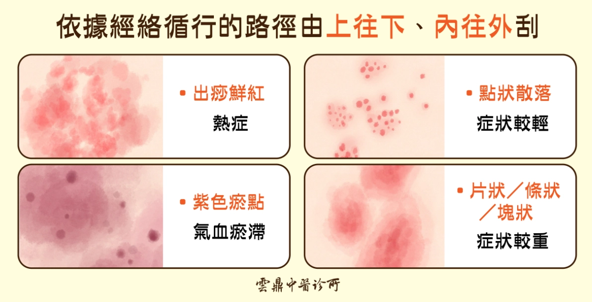 痧色 痧色