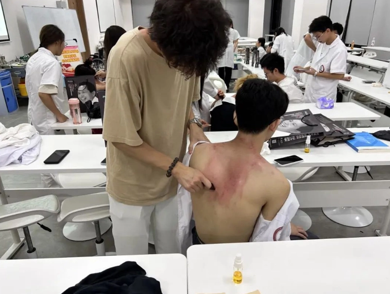 頸部刮痧 頸部刮痧