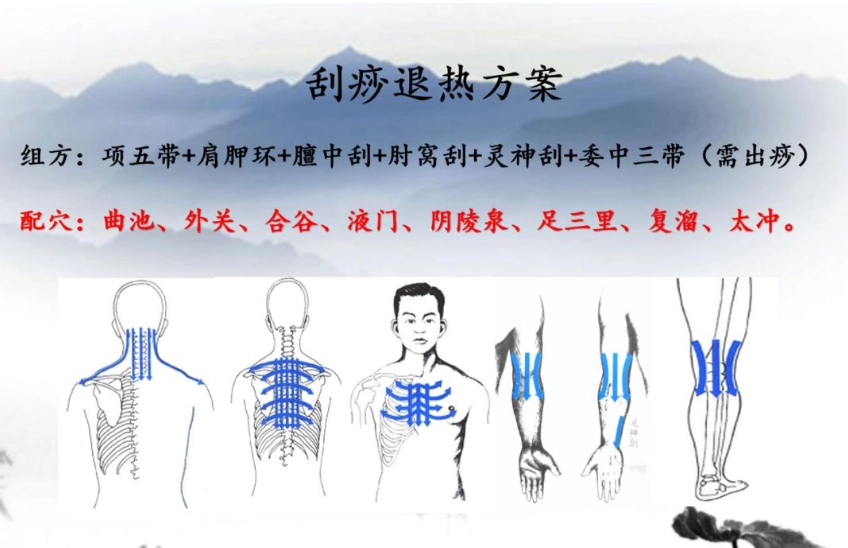 頸部刮痧 頸部刮痧