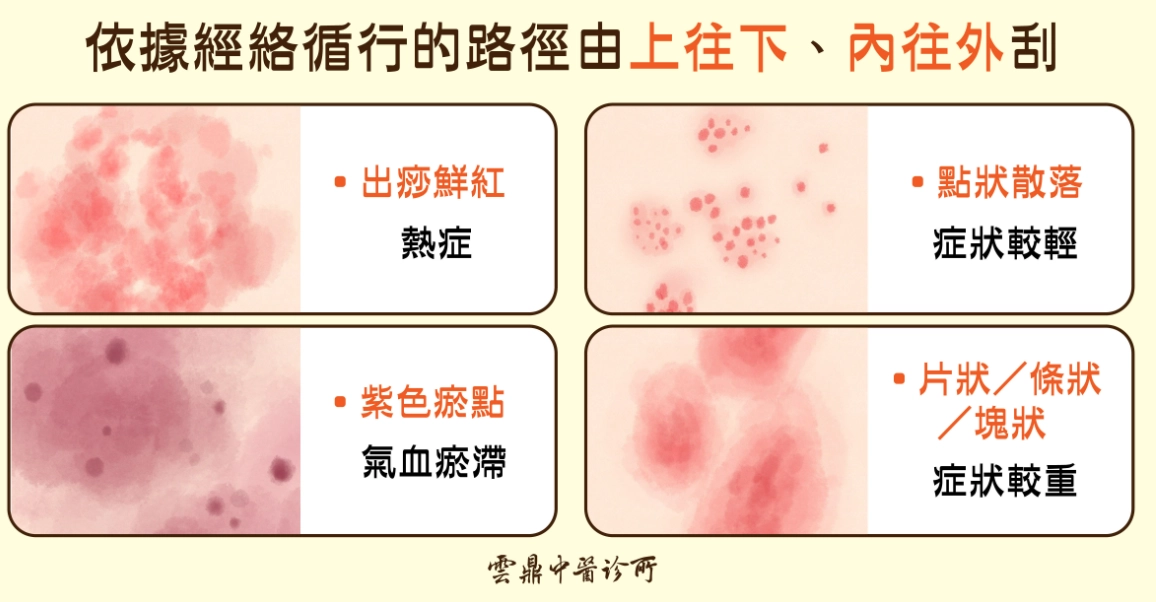 刮痧後遺症 刮痧後遺症