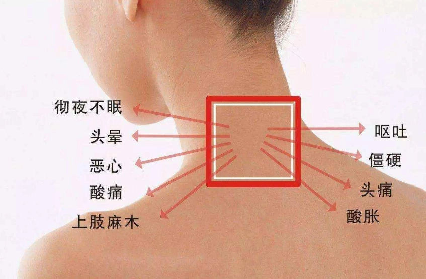 刮痧後遺症 刮痧後遺症