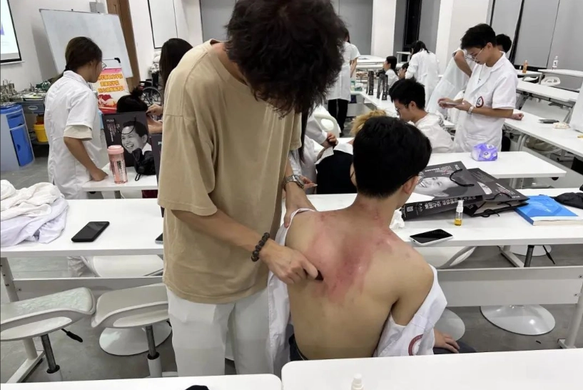 出痧顏色 出痧顏色