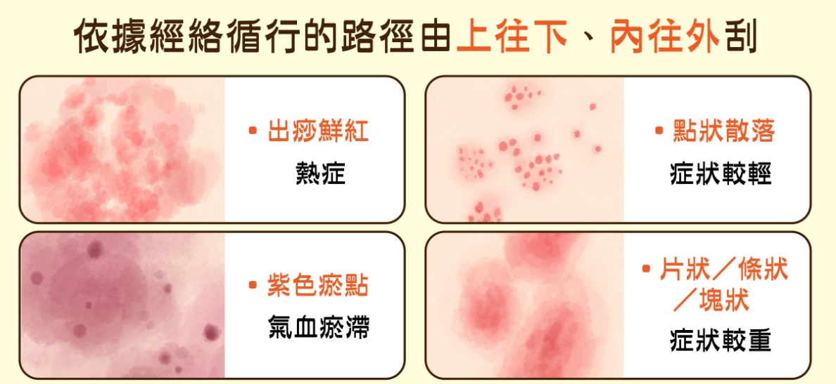 刮痧禁忌 刮痧禁忌