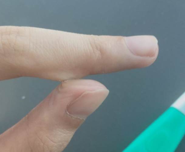 手沾膠水處理
